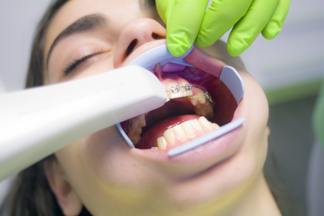 Un dentiste appliquant des gemmes dentaires sur les dents d'un patient